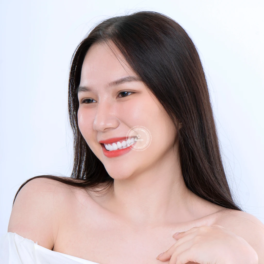 Bọc răng sứ tại nha khoa Dentos chỉ mất 2 đến 3 lần hẹn